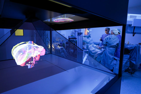 Hologram used to perform complex surgery (Courtesy of  Hospital de Sant Pau)